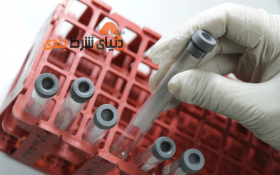 درمان کامل دومین بیمار مبتلا به اچ ای وی در لندن