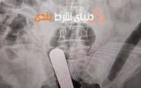 میله در مقعد!! عجیب ترین شرط بندی سال!!